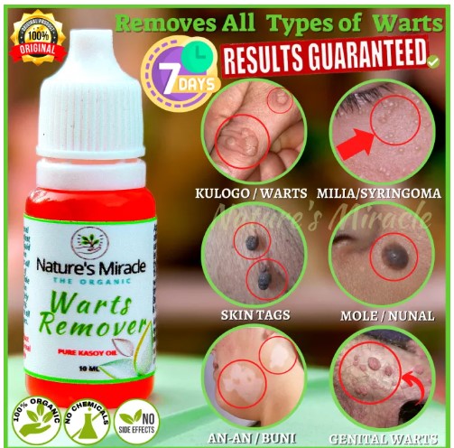 Wart Remover Skin Tag